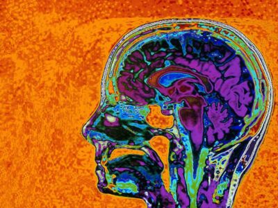 Using Psychology to Lose Weight and Stop The Inner Saboteur! - Blog Post - Susi Lodola Counselling